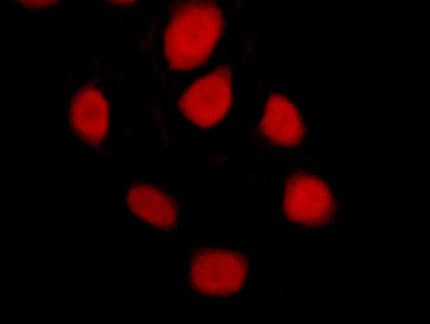 PR / Progesterone Receptor Antibody