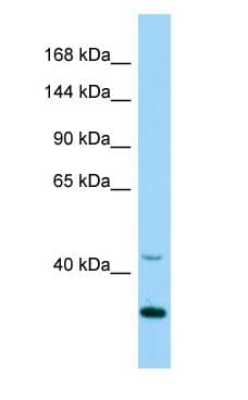CDK5 Antibody (aa101-150)