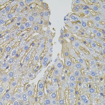 IHC-plus™ SLC1A4 / ASCT1 Antibody