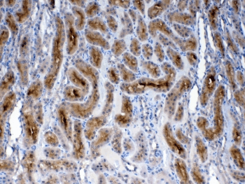 FZD3 / Frizzled 3 Antibody