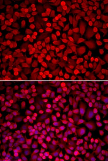 NCOA1 / SRC-1 Antibody