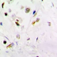 Polyclonal Rabbit anti-Human PSMB10 Antibody (IHC, IF, WB)
