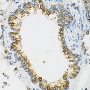 PI3 / Elafin Antibody