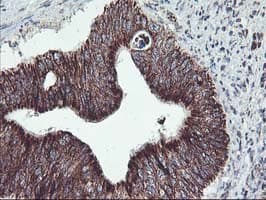 TRAP1 / HSP75 Antibody (clone OTI1A1)