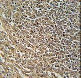 RASAL3 Antibody (aa947-975)