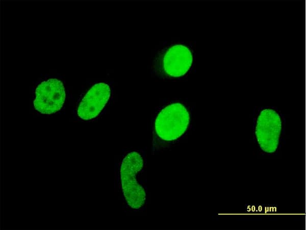 IHC-plus™ AML1 / RUNX1 Antibody (clone 3A8)
