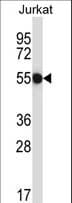 CNOT2 Antibody (aa272-301)