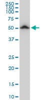 IHC-plus™ TUBB2A / Tubulin Beta 2A Antibody (clone 3B2)