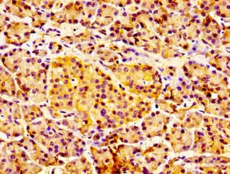 Polyclonal Rabbit anti-Human CDw218a / IL18R1 Antibody (IHC, WB)