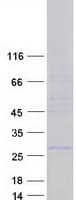 Human RAB37 Protein (Recombinant Myc-DDK (Flag))