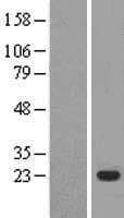 Human RPL11 / Ribosomal Protein L11 (Over-Expression Lysate Myc-DDK (Flag))