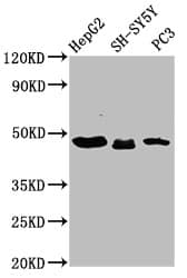 Polyclonal Rabbit anti-Human CXorf36 Antibody (IHC, WB)