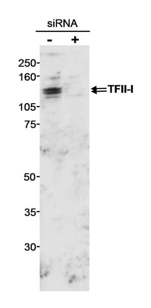 GTF2I / TFII I Antibody (aa950-C-term)