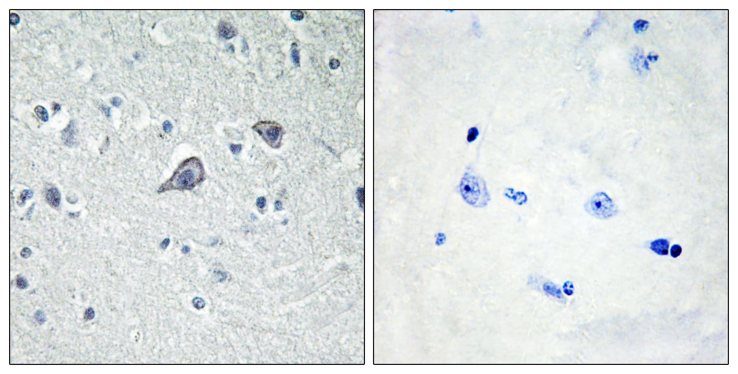 Polyclonal Rabbit anti-Human ADORA2A/Adenosine A2A Receptor Antibody (aa120-169, IHC, IF)