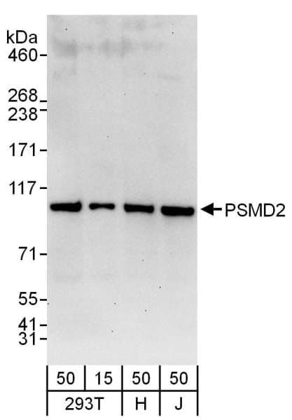 Polyclonal Rabbit anti-Human PSMD2 Antibody (aa50-100, IHC, WB)