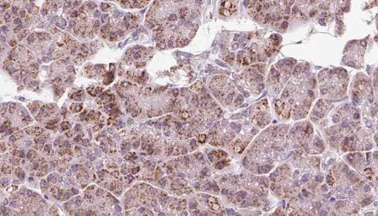 GPD2 Antibody