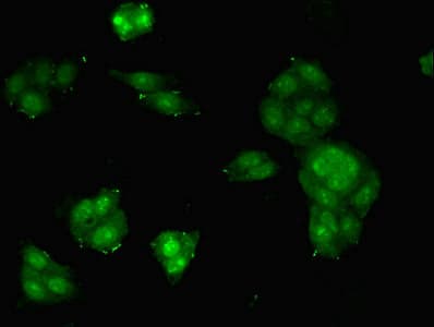 Polyclonal Rabbit anti-Human MDK / Midkine Antibody (WB)