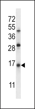 IHC-plus™ SFTPC / Surfactant Protein C Antibody (aa144-173)
