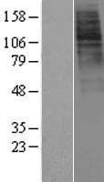 GHSR / Ghrelin Receptor Protein (Over-Expression Lysate Myc-DDK (Flag))