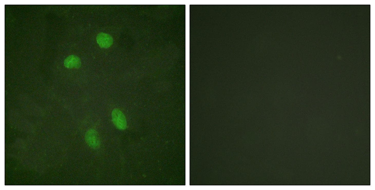 ATF2 Antibody (Ab-480)