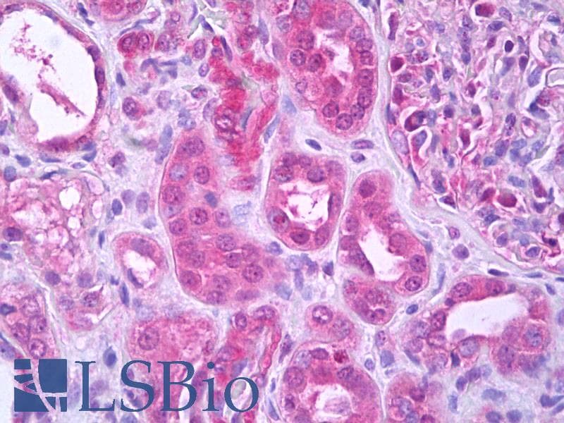 IHC-plus™ Monoclonal Mouse anti-Human Hamartin / TSC1 Antibody (IHC, WB)