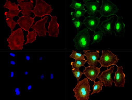 NBN / Nibrin Antibody (aa183-460, clone UMAB100, Carrier-free)