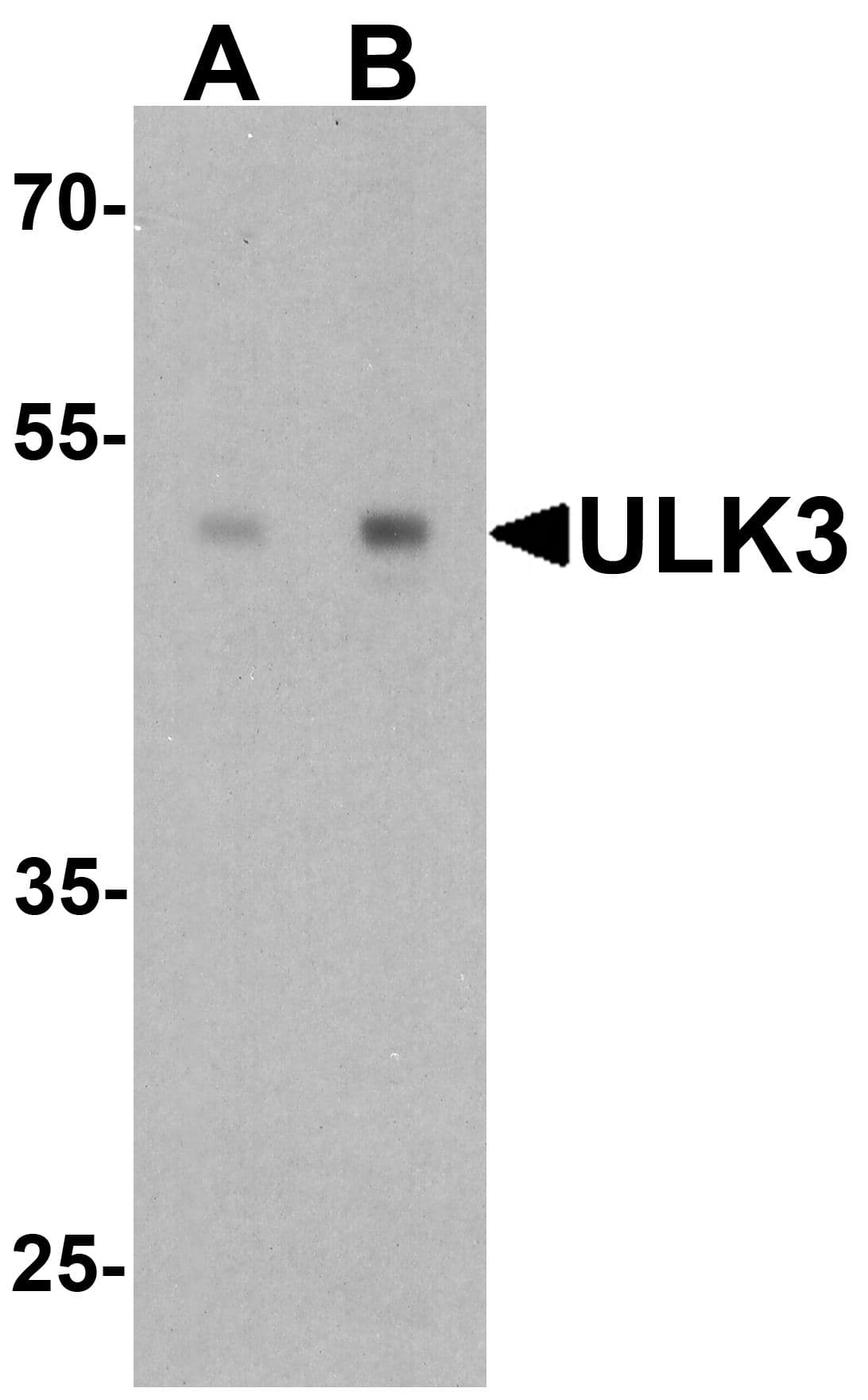 IHC-plus™ Polyclonal Rabbit anti-Human ULK3 Antibody (IHC, IF, WB)