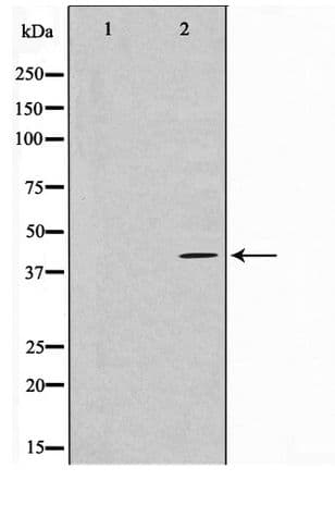 Polyclonal Rabbit anti-Human GAS41 Antibody (WB)