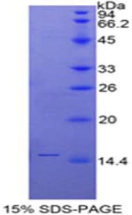 Human SLURP1 / ARS / MDM Protein (Recombinant His-T7)