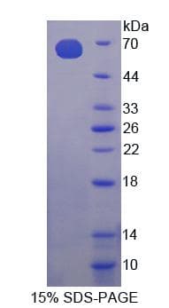 Mouse CHKA / CK / Choline Kinase Protein (Recombinant His-GST, N-terminus)
