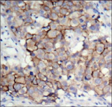 ERBB2 / HER2 Antibody