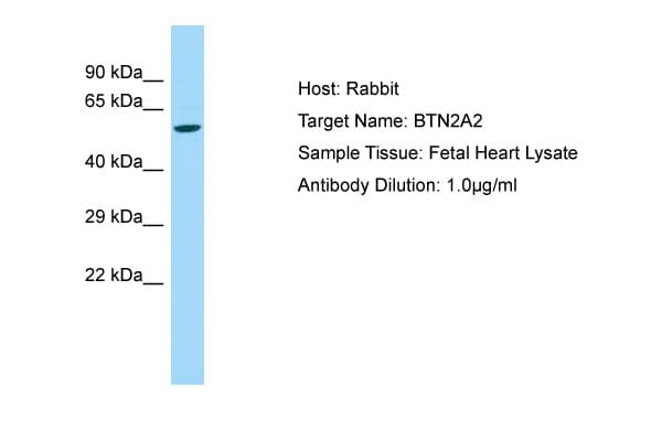 BTN2A2 Antibody (aa64-113)
