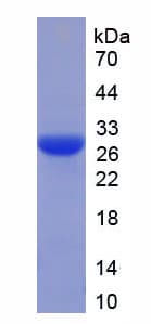 Human Nerve Growth Factor Protein (Recombinant His, N-Terminal)