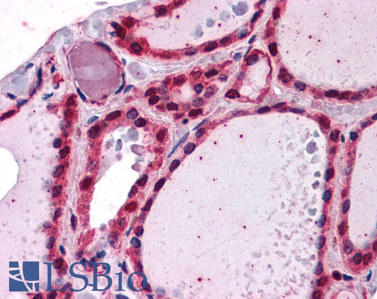 IHC-plus™ Monoclonal Mouse anti-Human IRAK1 / IRAK Antibody (clone 3A9, IHC, IF, WB)
