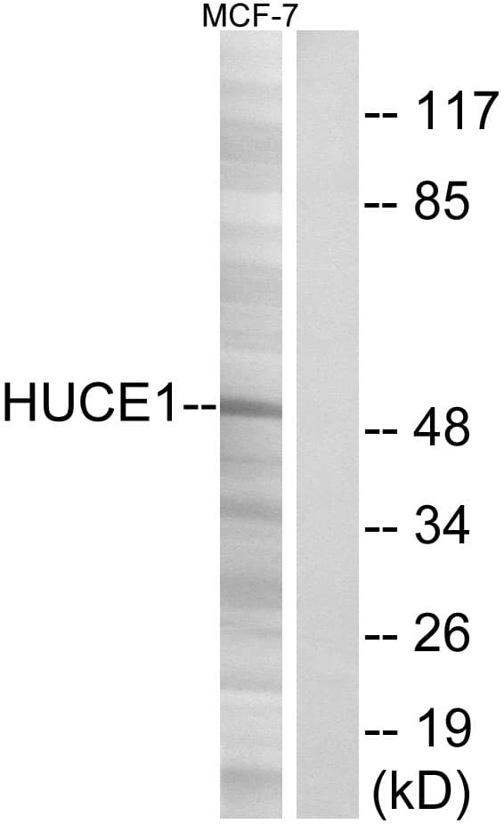 Polyclonal Rabbit anti-Human RRP8 Antibody (aa271-320, WB)