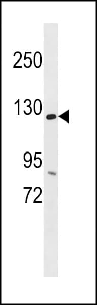 ANKS1A / ODIN Antibody (aa293-319)