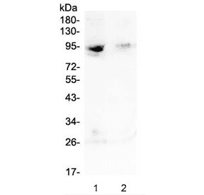 RASAL1 / RASAL Antibody