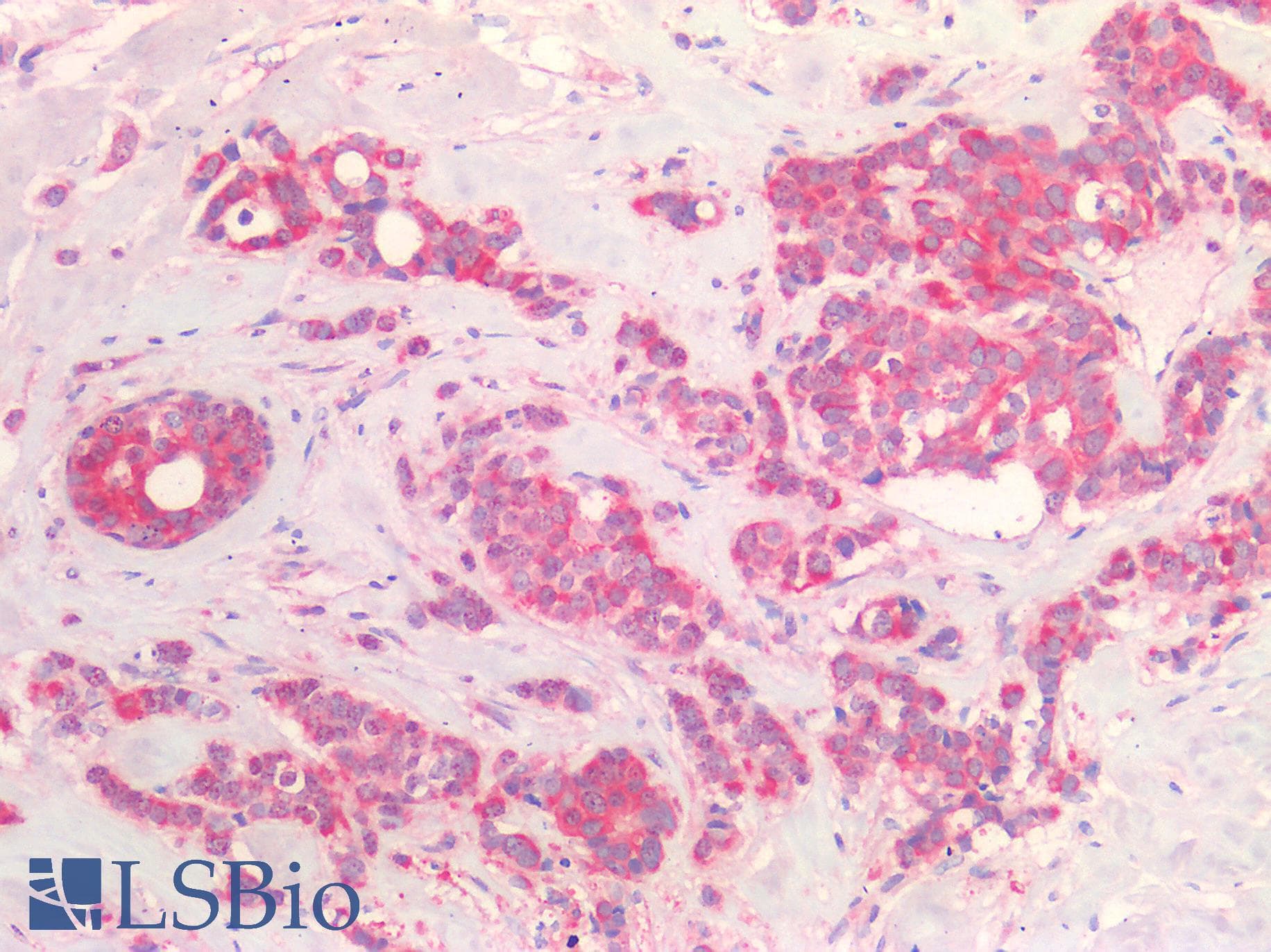 PathPlus™ Polyclonal Rabbit anti-Human ERBB2 / HER2 Antibody (IHC)