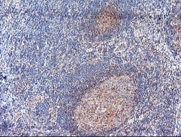 ACY1 / Aminoacylase 1 Antibody (clone OTI2F1)