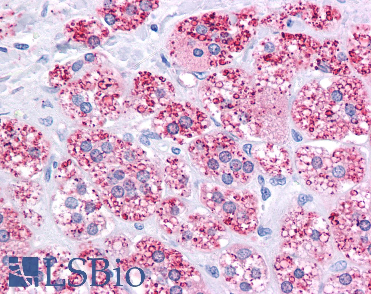 ABCB1 / MDR1 / P Glycoprotein Antibody (aa863-912)