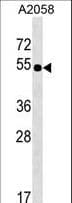 Polyclonal Rabbit anti-Human SLC9B2 / NHEDC2 Antibody (aa458-486, WB)