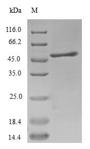 Human SEMG1 Protein (Recombinant 6His-SUMO, N-terminus)