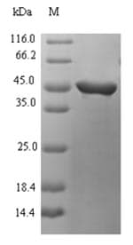 Streptococcus pyogenes speB Protein (Recombinant 6His-SUMO, N-terminus)