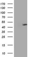 MTFMT Antibody (aa175-389, clone OTI1C1)