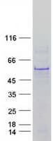 Human TP53 / p53 Protein (Recombinant Myc-DDK (Flag))