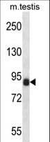 CCNT1 / Cyclin T1 Antibody (aa253-281)