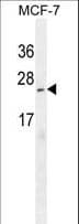 Polyclonal Rabbit anti-Human C9orf150 Antibody (aa11-40, IHC, WB)