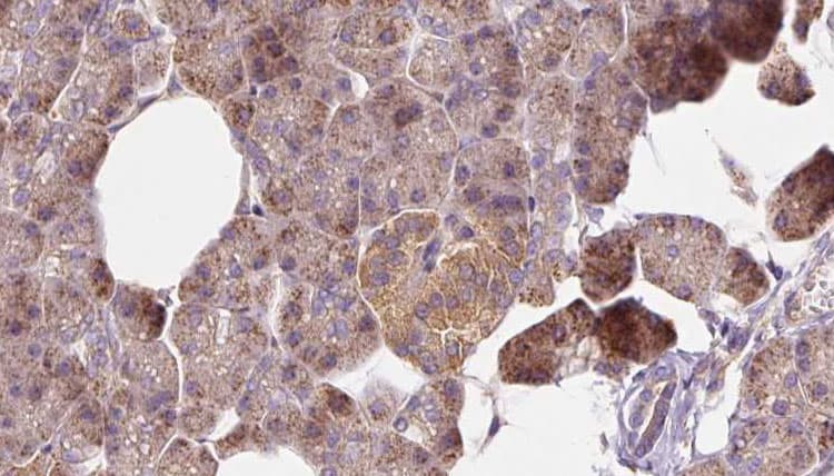 Polyclonal Rabbit anti-Human FTHFSDC1 / MTHFD1L Antibody (IHC, IF, WB)