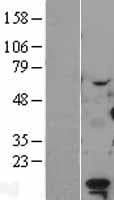 LDOC1 Protein (Over-Expression Lysate Myc-DDK (Flag))