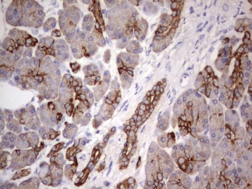 Monoclonal Rat anti-Human Acidic Cytokeratin Antibody (clone 2G10, IHC)